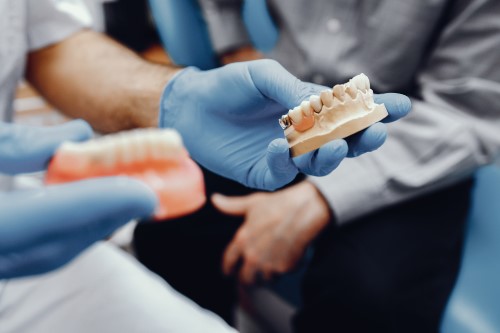 Implante dental tratamiento en JM Sevilla Dental